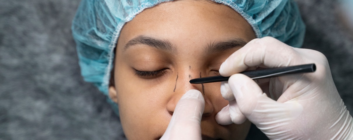Before and After Rhinoplasty: What Foreign Patients Should Expect