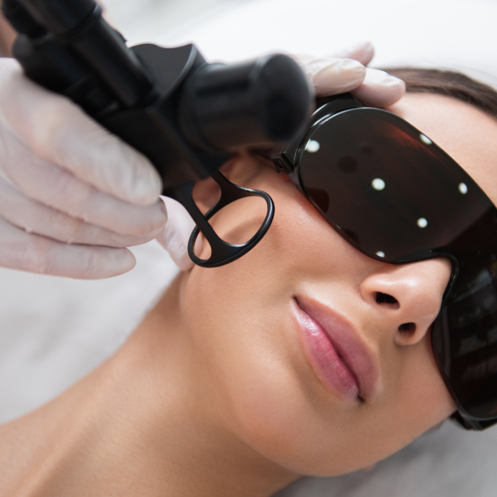 Leke Tedavisinde En Yeni Teknolojiler: Fraksiyonel Lazer, Kimyasal Peeling