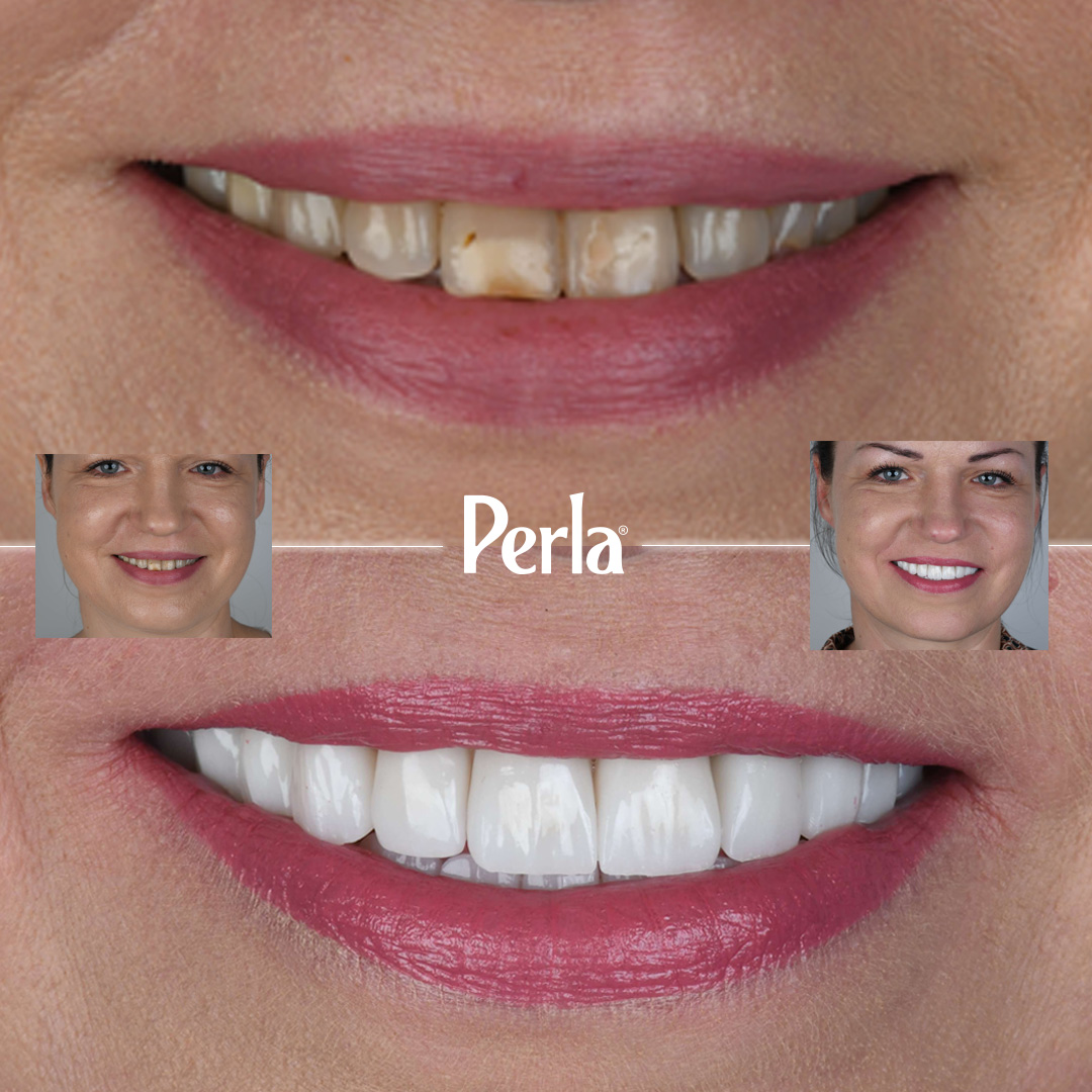 Antalya Perla Dent Dental Clinic Private Dental Clinic Dental